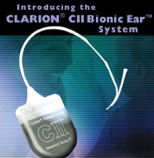 Clarion Bionic Ear Image